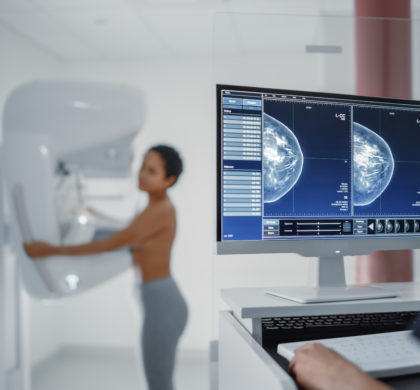 Computer Screen in Hospital Radiology Room: Beautiful Multiethnic Young Woman Standing Topless Undergoing Mammography Screening Procedure. Screen Showing the Mammogram Scans of Dense Breast Tissues.
